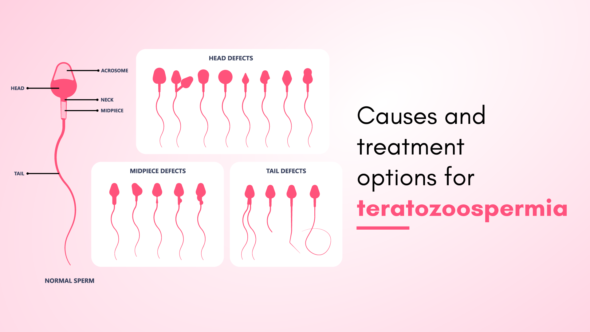 Causes and Treatment Options for Teratozoospermia