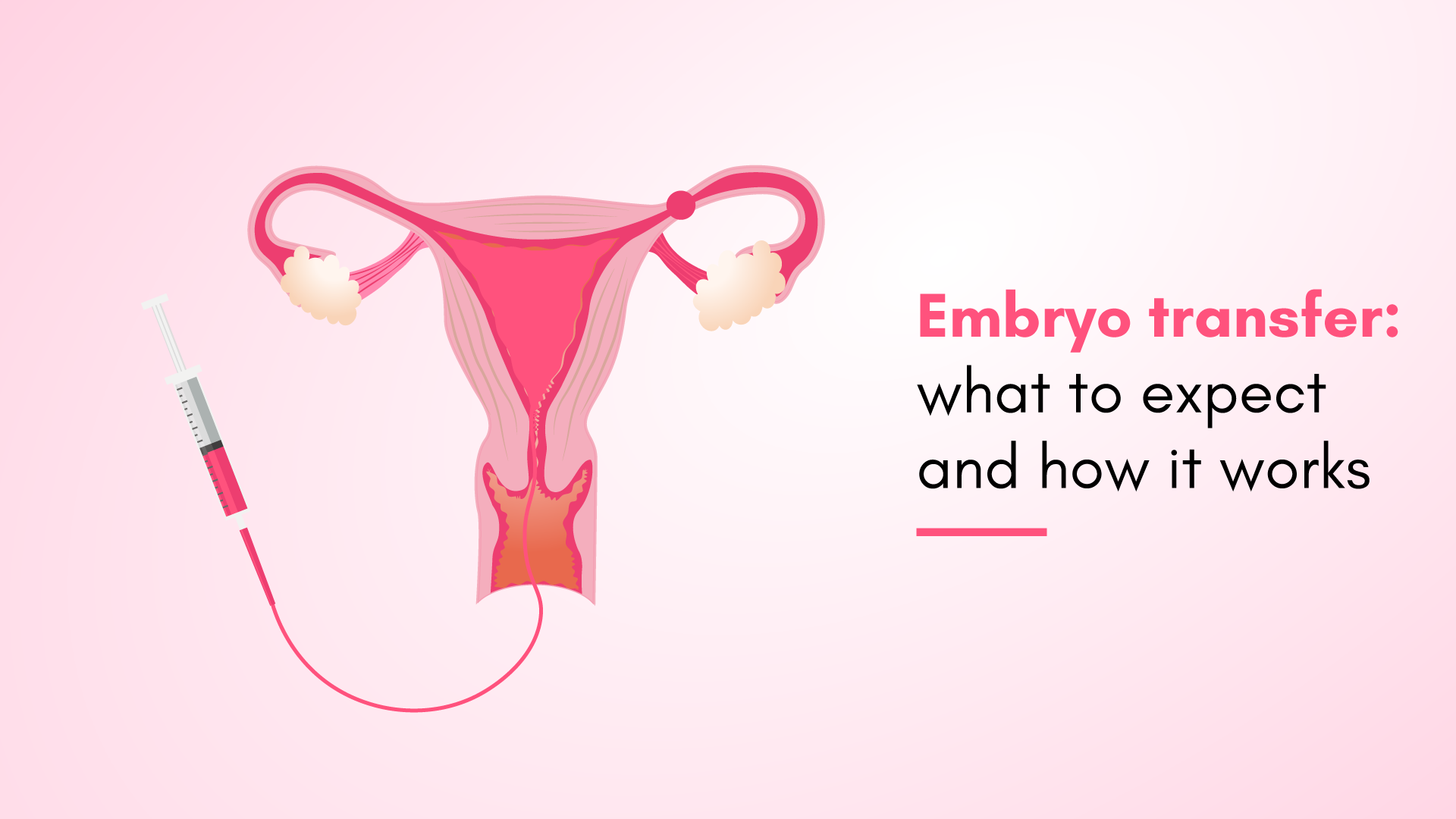 Embryo Transfer: What To Expect And How It Works?