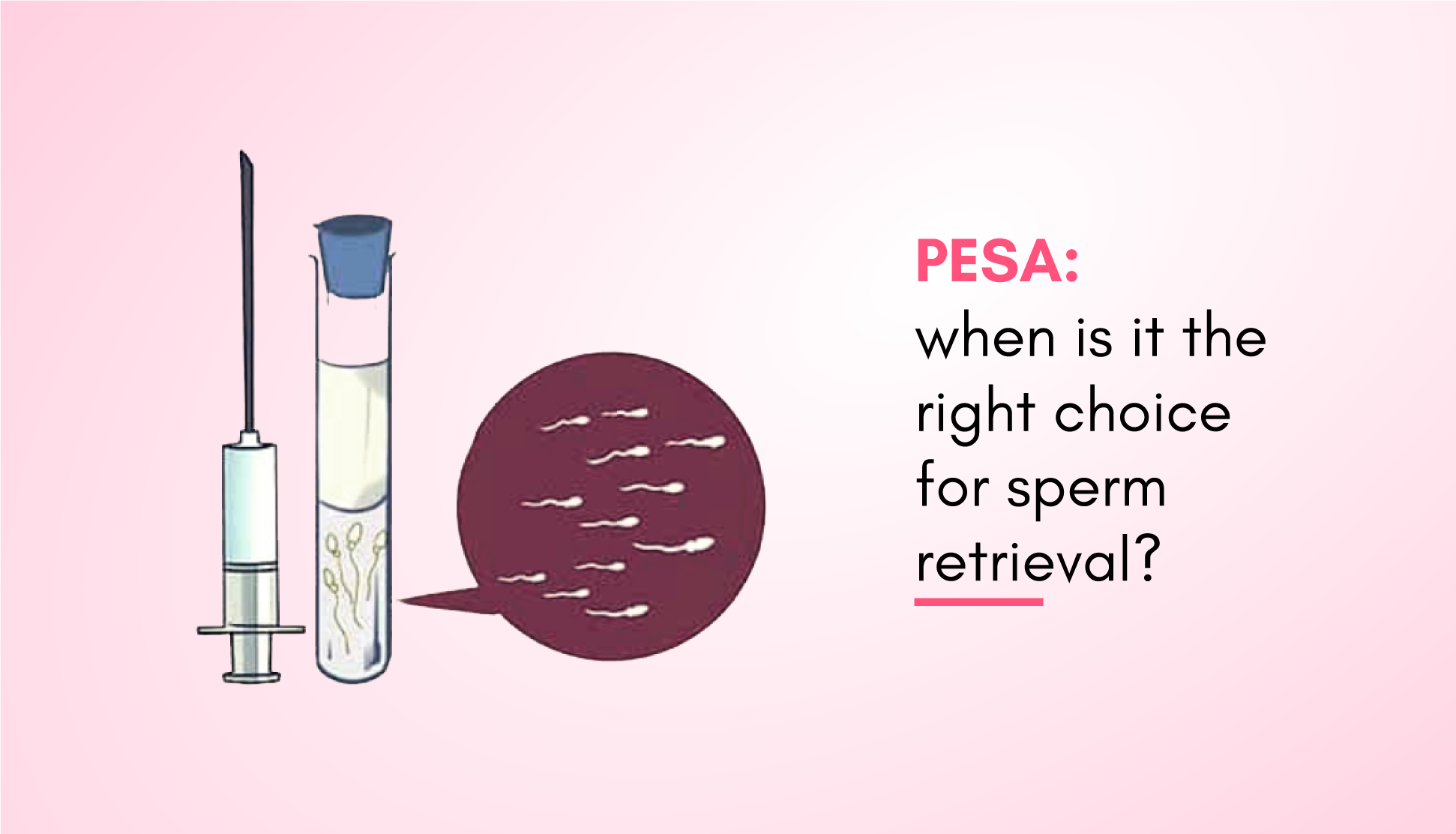 PESA: When is it the Right Choice for Sperm Retrieval?