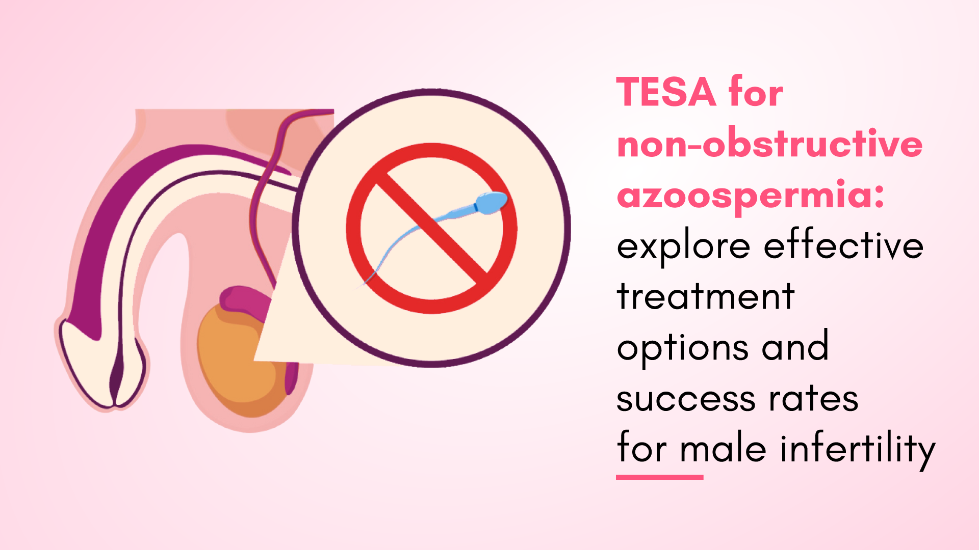 TESA for Non-Obstructive Azoospermia: Explore Effective Treatment Options and Success Rates for Male Infertility