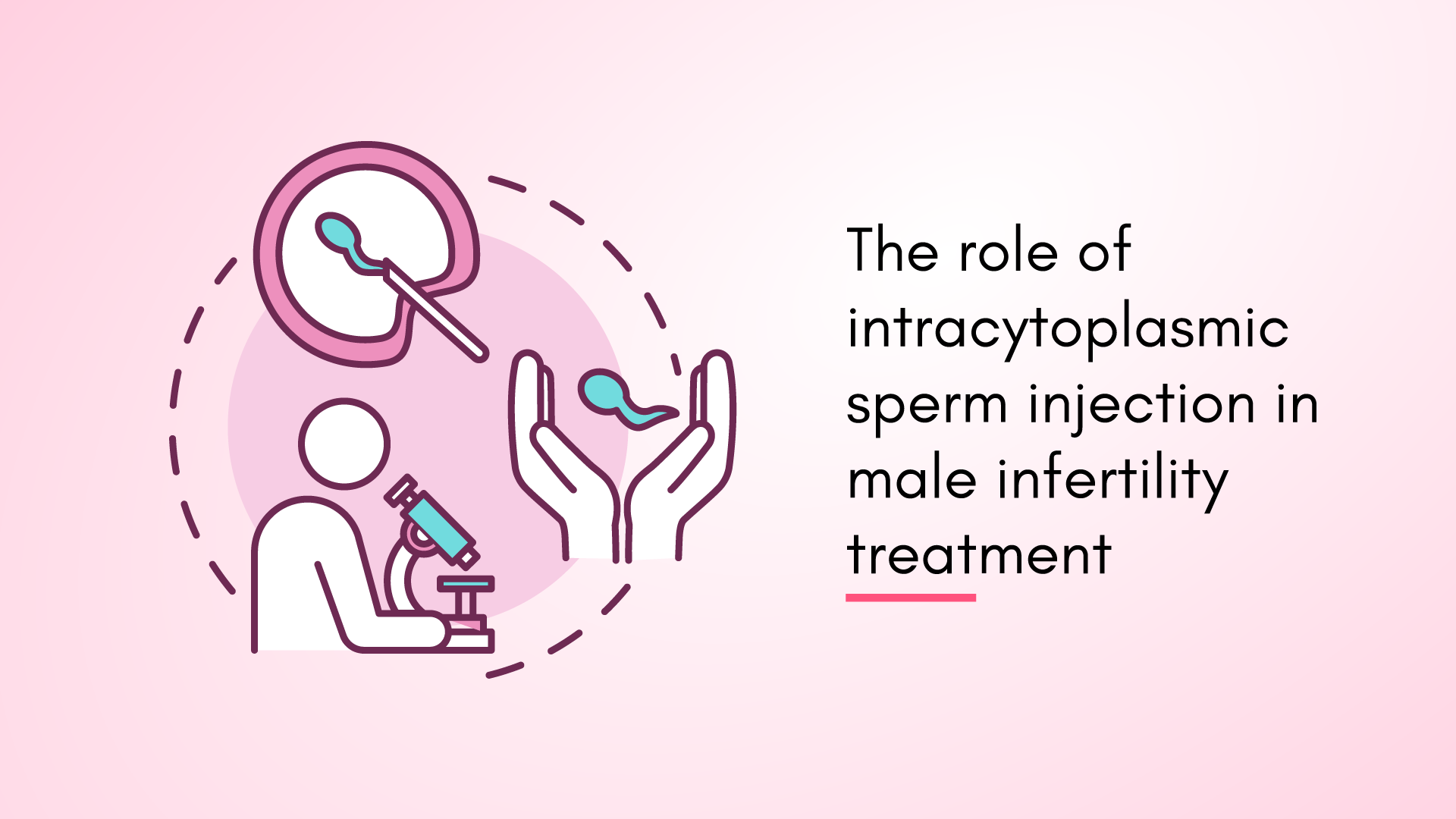 The Role of Intracytoplasmic Sperm Injection in Male Infertility Treatment