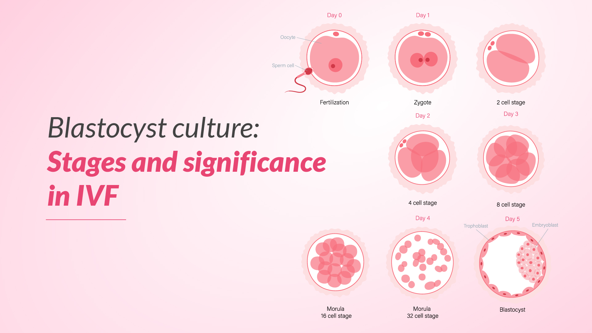 Blastocyst Culture: Stages and Significance in IVF