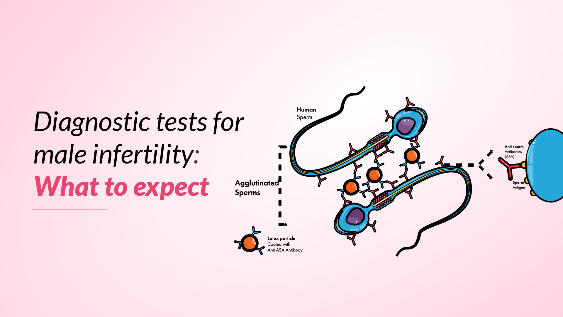 Diagnostic Tests for Male Infertility: What to Expect