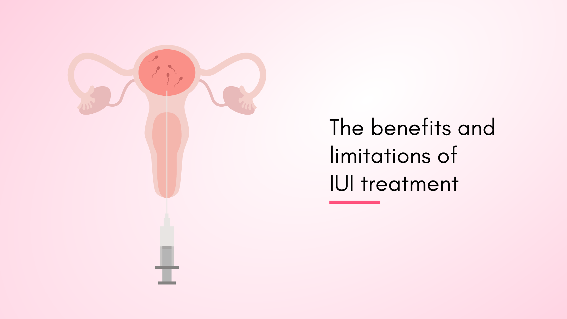 The Benefits and Limitations of IUI Treatment