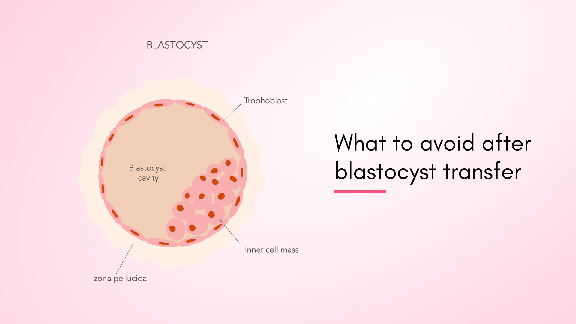 What to Avoid After Blastocyst Transfer