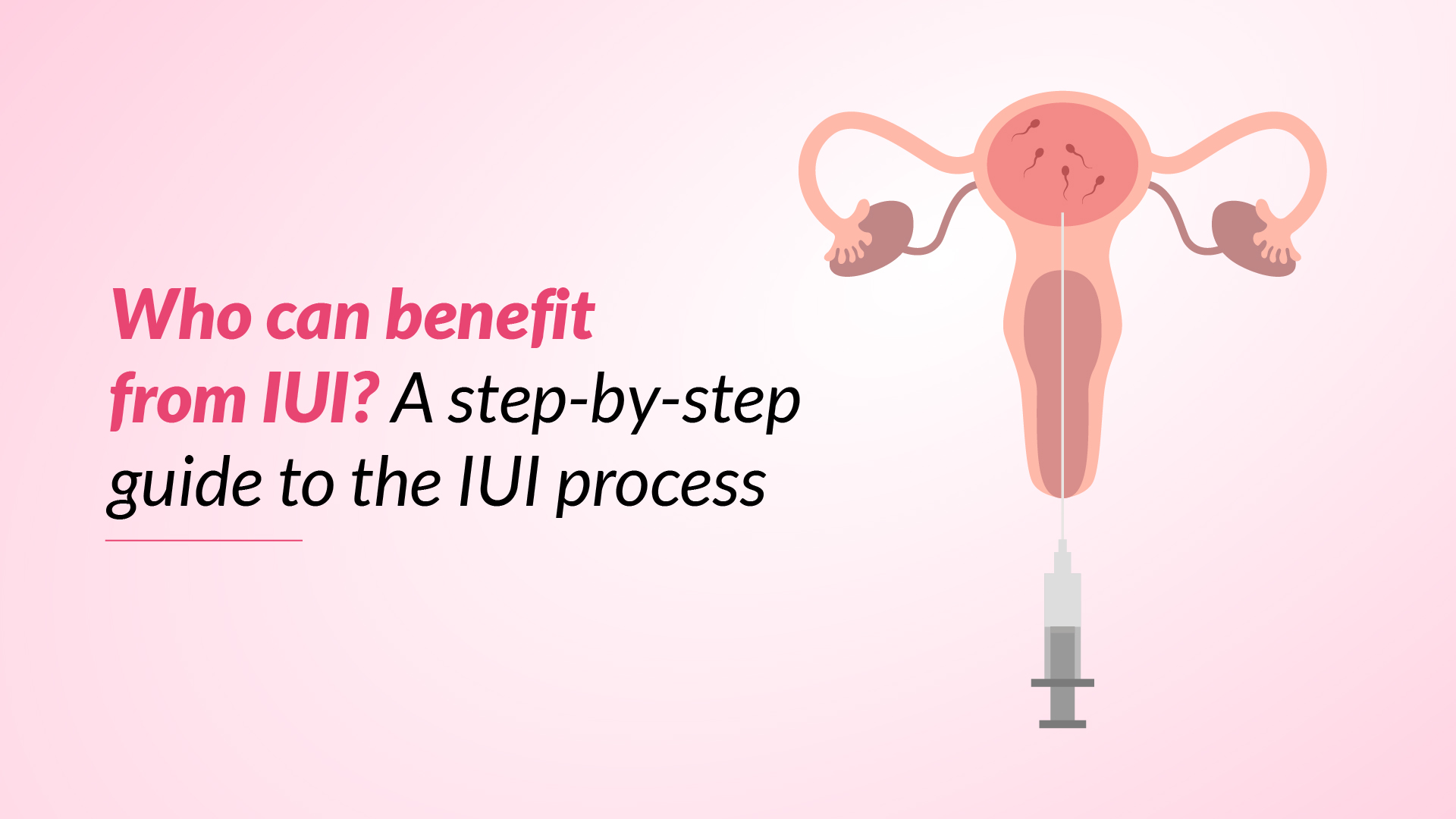 Who Can Benefit from IUI? Step-by-Step Guide to the IUI Process 