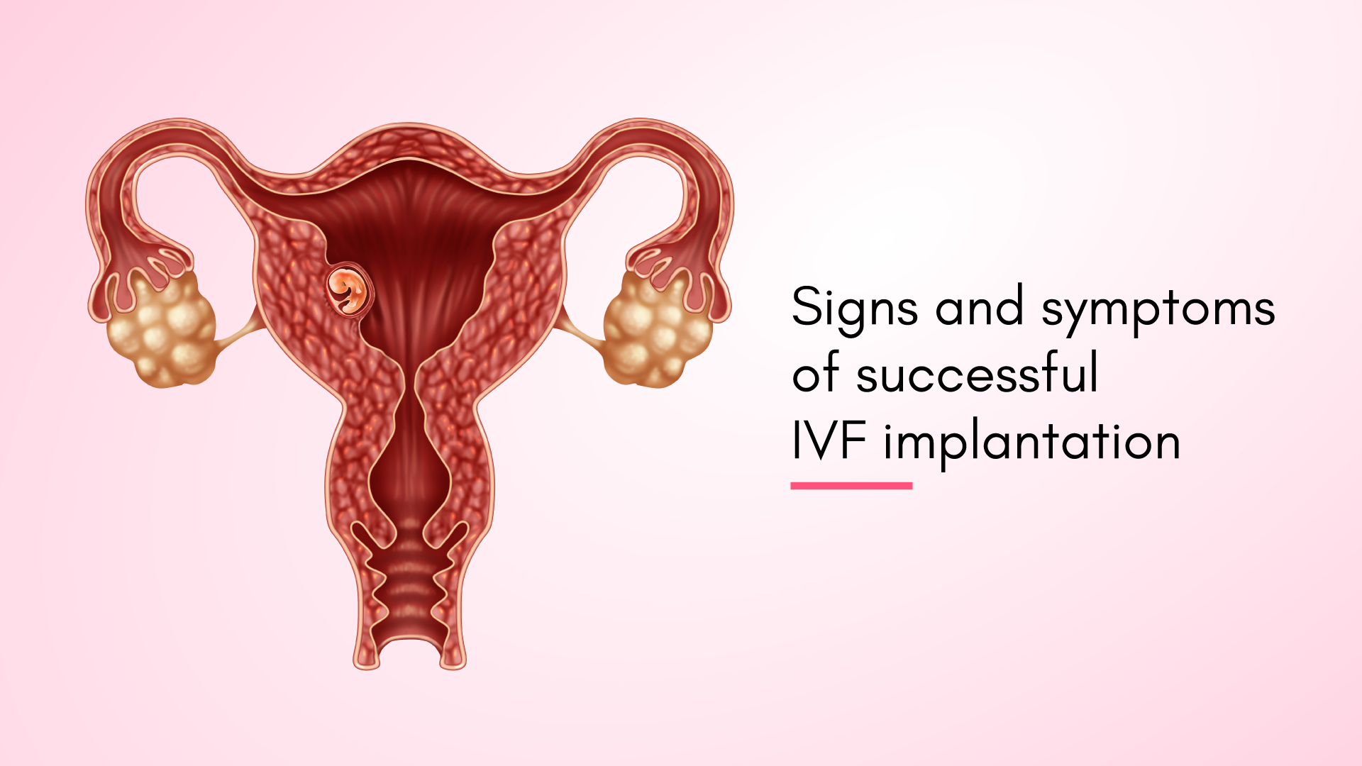 Signs and Symptoms of Successful IVF Implantation