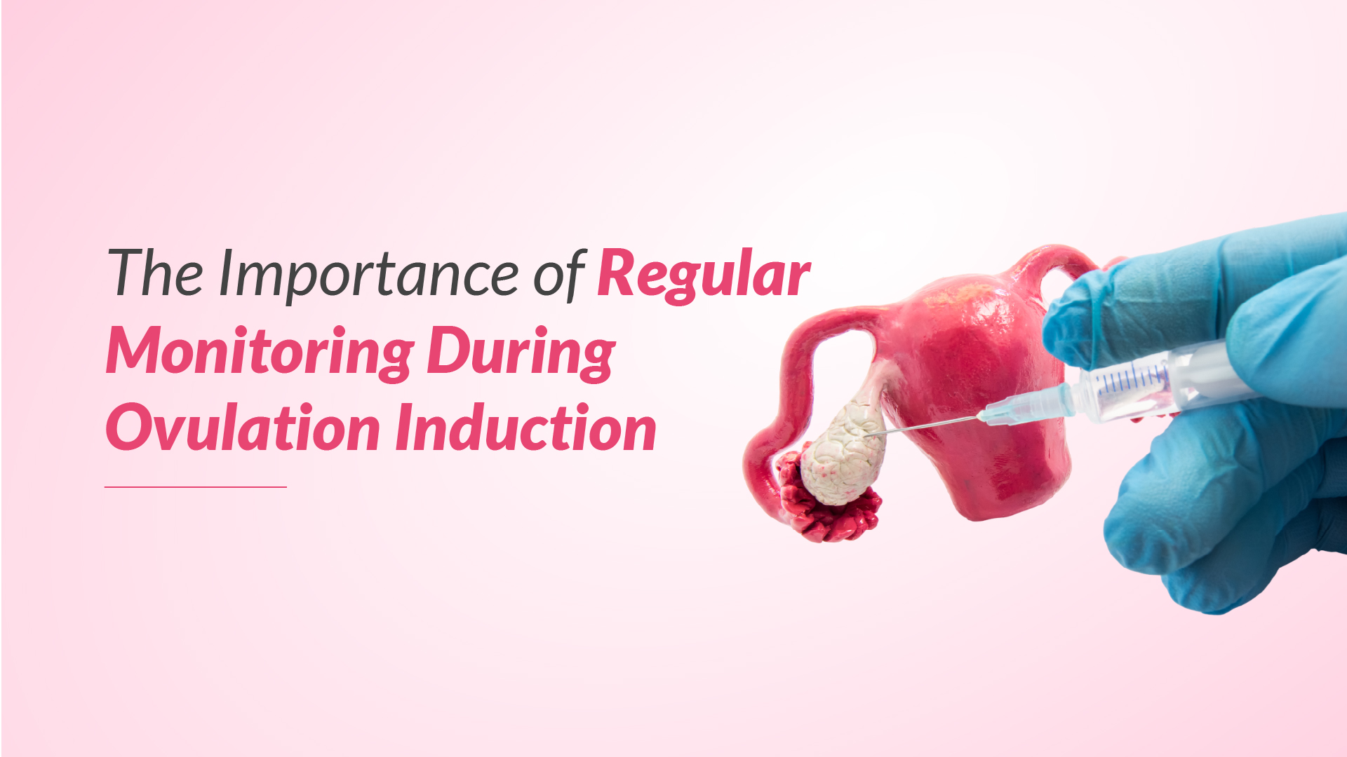 The Importance of Regular Monitoring During Ovulation Induction