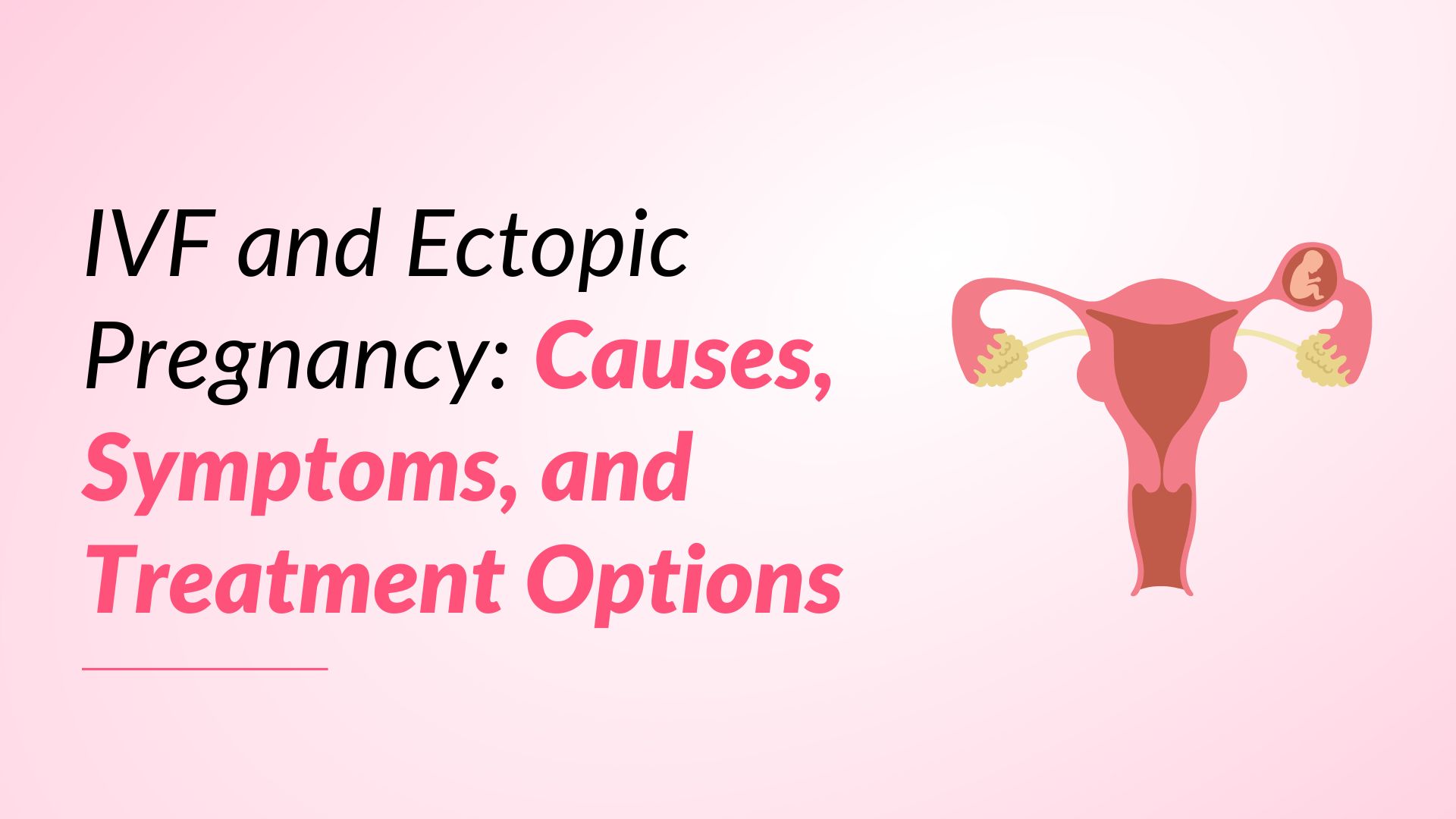 What is an Ectopic Pregnancy?